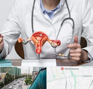 جراح سرطان رحم در بلوار فرحزادی