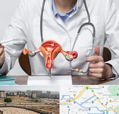 جراح سرطان رحم در کوی وحدت شیراز 