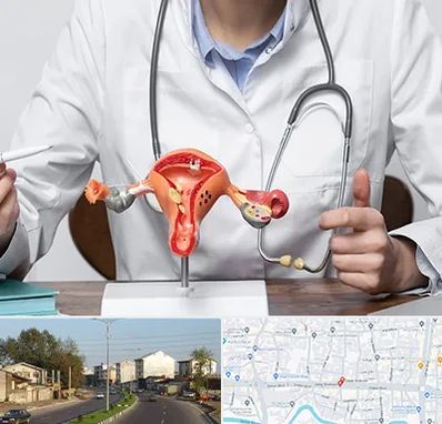 جراح سرطان رحم در ضیابری رشت 