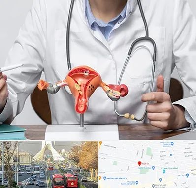 جراح سرطان رحم در خیابان آزادی 