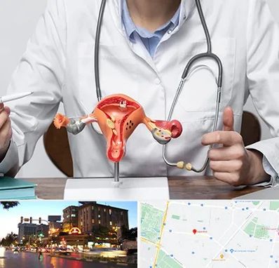 جراح سرطان رحم در بلوار سجاد مشهد 