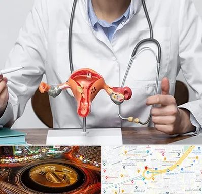 جراح سرطان رحم در میدان ولیعصر 