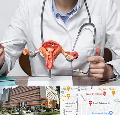 جراح سرطان رحم در سهروردی 