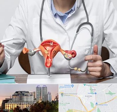 جراح سرطان رحم در فرشته 