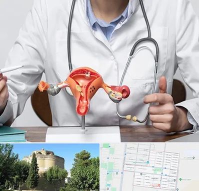 جراح سرطان رحم در مرداویج اصفهان 