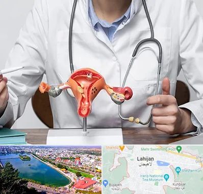 جراح سرطان رحم در لاهیجان