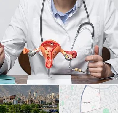 جراح سرطان رحم در جمشیدیه