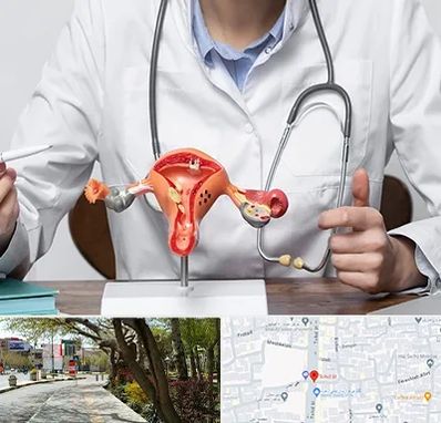 جراح سرطان رحم در خیابان توحید اصفهان 