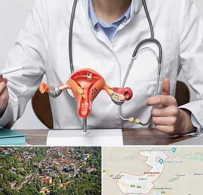 جراح سرطان رحم در دماوند