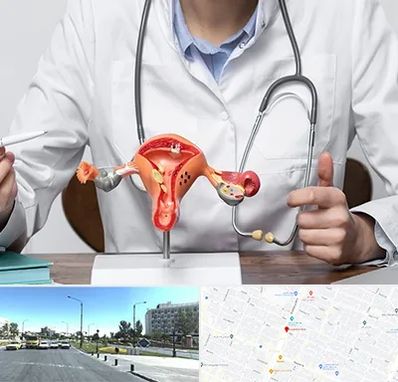 جراح سرطان رحم در بلوار کلاهدوز مشهد 