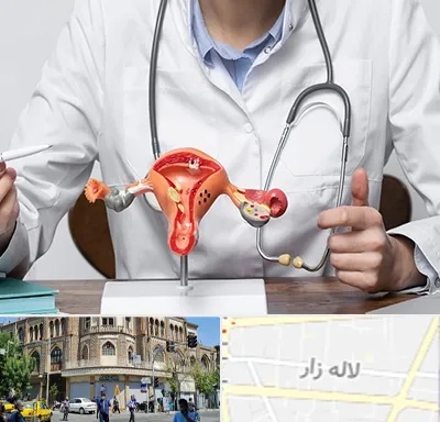 جراح سرطان رحم در لاله زار