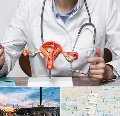 جراح سرطان رحم در منطقه 2 تهران 