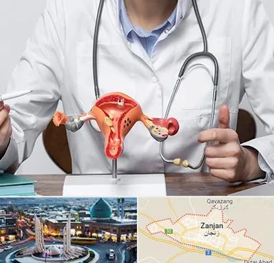 جراح سرطان رحم در زنجان