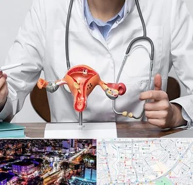 جراح سرطان رحم در منظریه رشت 