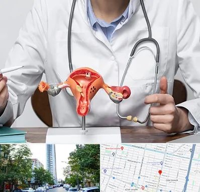 جراح سرطان رحم در امامت مشهد 