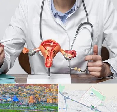 جراح سرطان رحم در رشدیه تبریز