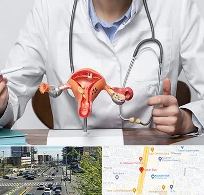 جراح سرطان رحم در ستاری 