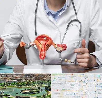 جراح سرطان رحم در منطقه 9 تهران 