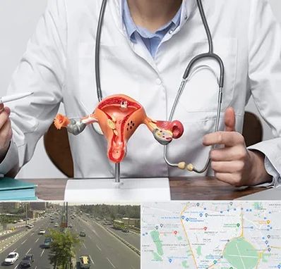 جراح سرطان رحم در منطقه 17 تهران 