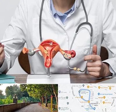 جراح سرطان رحم در فلکه گاز رشت 