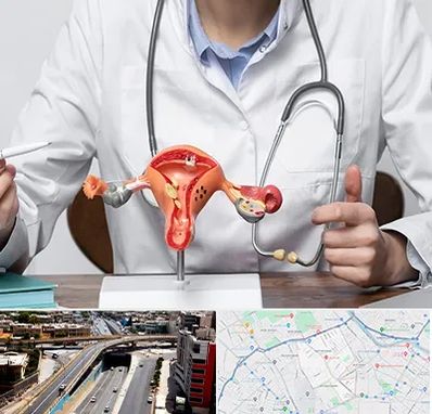 جراح سرطان رحم در ستارخان شیراز 