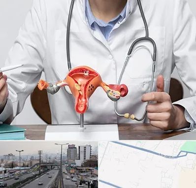 جراح سرطان رحم در بلوار ارتش