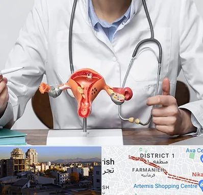 جراح سرطان رحم در فرمانیه 