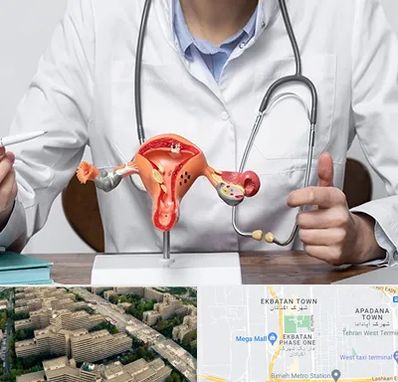 جراح سرطان رحم در اکباتان 