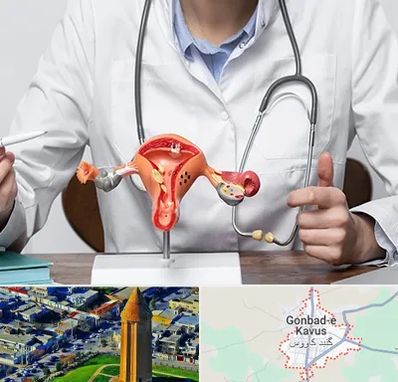 جراح سرطان رحم در گنبد کاووس