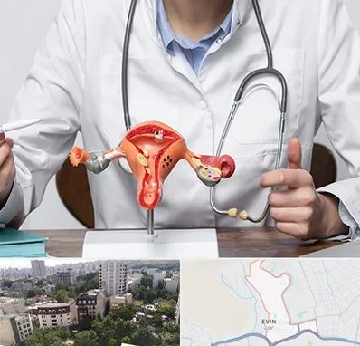 جراح سرطان رحم در اوین