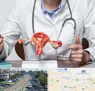 جراح سرطان رحم در جنوب تهران 