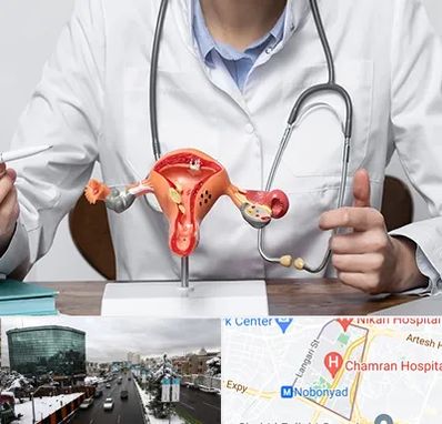 جراح سرطان رحم در اقدسیه 