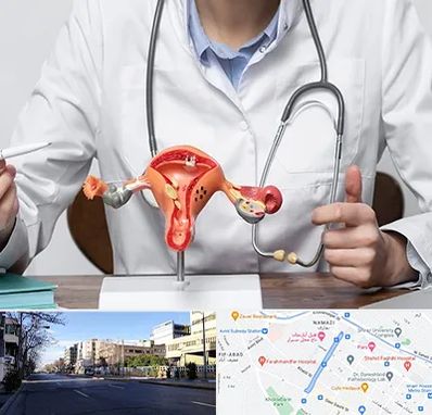 جراح سرطان رحم در خیابان ملاصدرا شیراز 