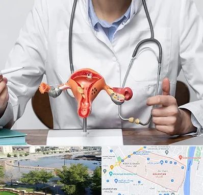 جراح سرطان رحم در گلستان اهواز 