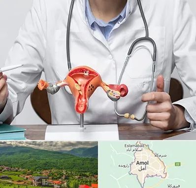 جراح سرطان رحم در آمل