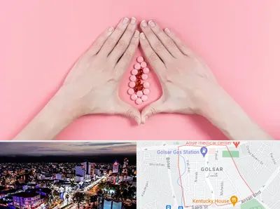 دکتر سرطان واژن در گلسار رشت 