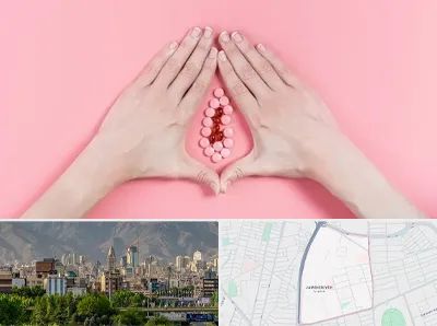 دکتر سرطان واژن در جمشیدیه