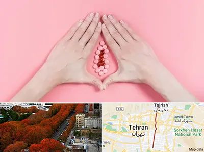 دکتر سرطان واژن در ولیعصر 