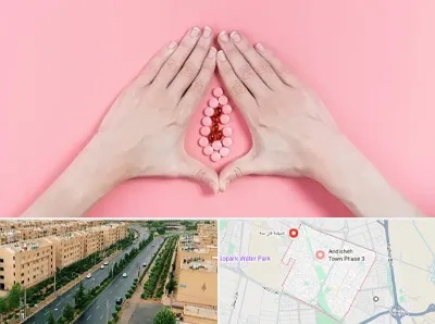دکتر سرطان واژن در فاز سه اندیشه