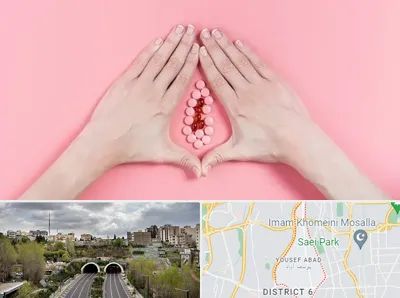 دکتر سرطان واژن در یوسف آباد 