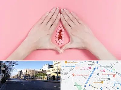 دکتر سرطان واژن در خیابان ملاصدرا شیراز 