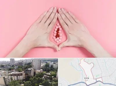 دکتر سرطان واژن در اوین