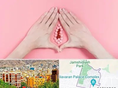 دکتر سرطان واژن در نیاوران 