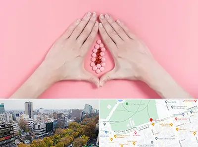 دکتر سرطان واژن در بلوار کشاورز 