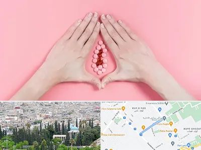 دکتر سرطان واژن در محلاتی شیراز 