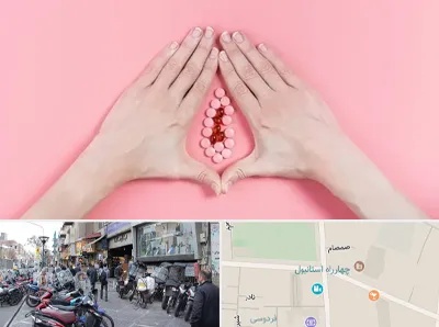 دکتر سرطان واژن در چهارراه استانبول