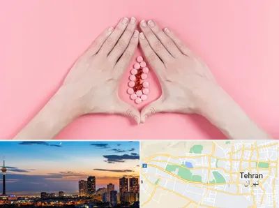 دکتر سرطان واژن در غرب تهران 