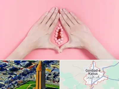 دکتر سرطان واژن در گنبد کاووس