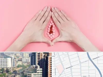 دکتر سرطان واژن در خیابان بهشتی