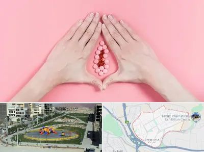 دکتر سرطان واژن در مرزداران تبریز